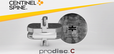 central-spine-prodisc-c-cervical-disc