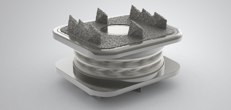 artificial-cervical-disc